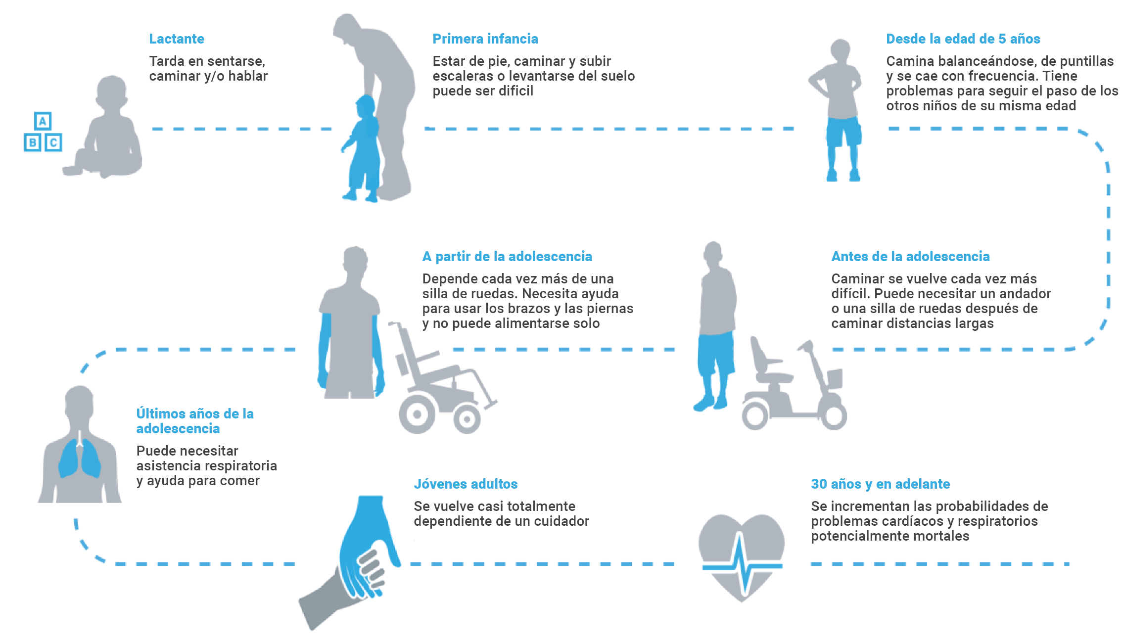 Ilustración de las diferentes etapas de progresión de la enfermedad de Duchenne